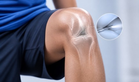 Sports Medicine & Arthroscopic Surgery